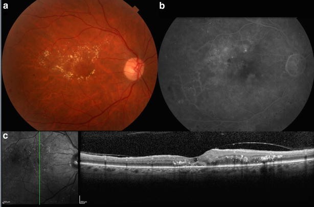 Fig. 3