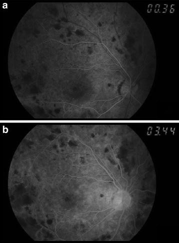 Fig. 3