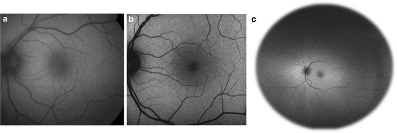 Fig. 3