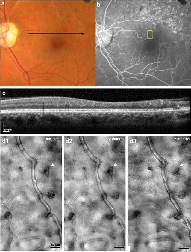 Fig. 10