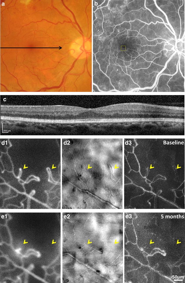 Fig. 11