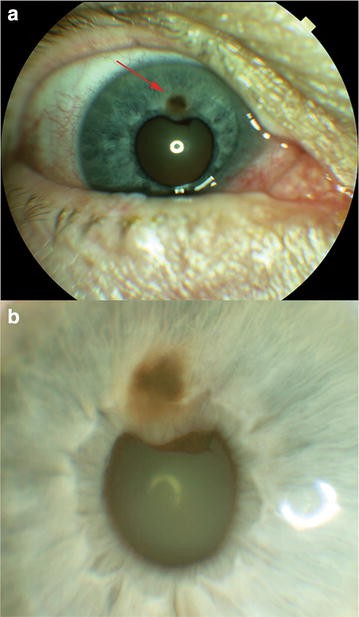 Fig. 1