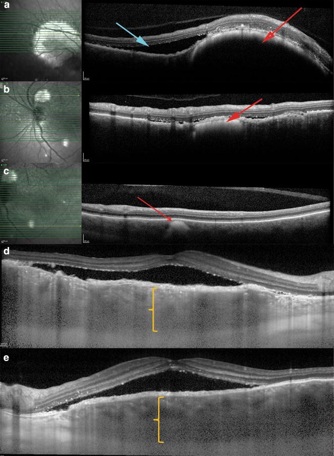 Fig. 3