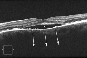 Fig. 1