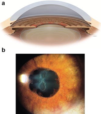 Fig. 1