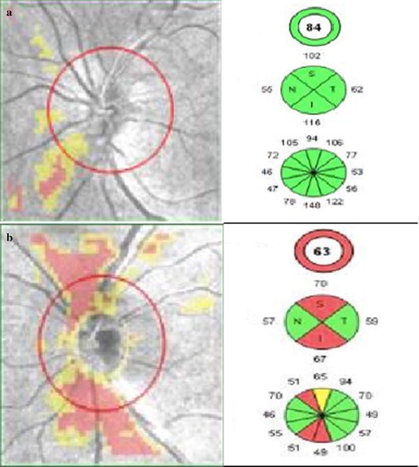 Fig. 2