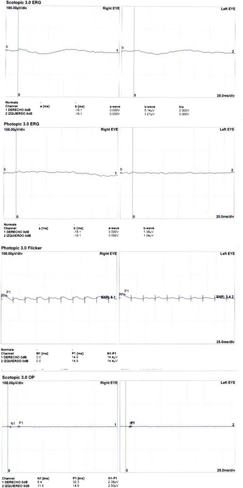 Fig. 2