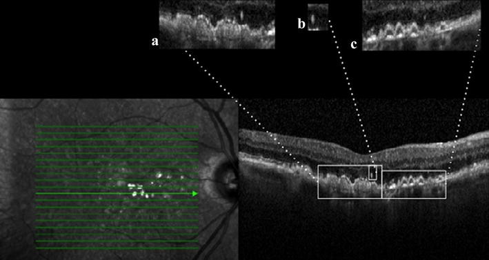 Fig. 1