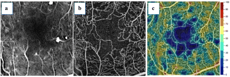 Fig. 4