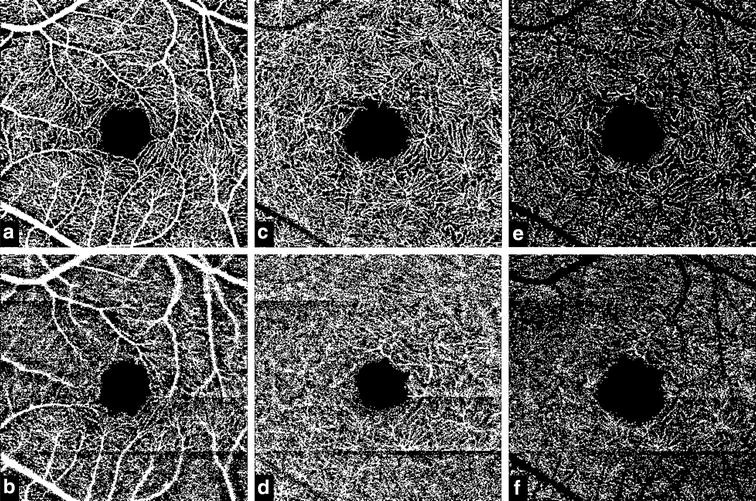 Fig. 2