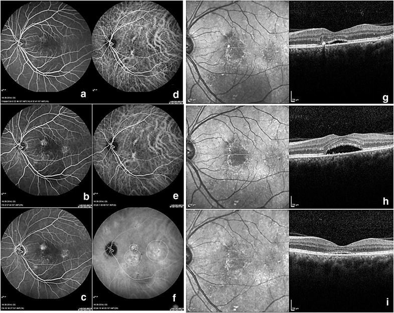 Fig. 1