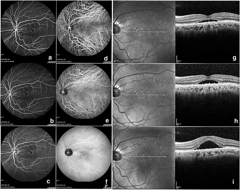 Fig. 2