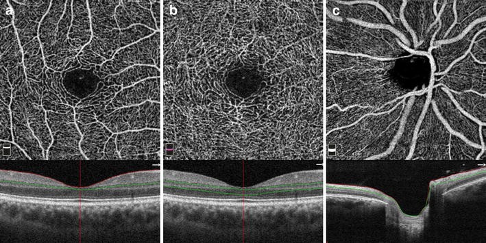 Fig. 1