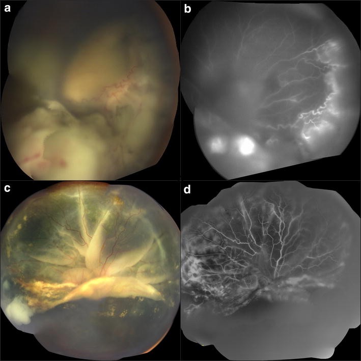 Fig. 1