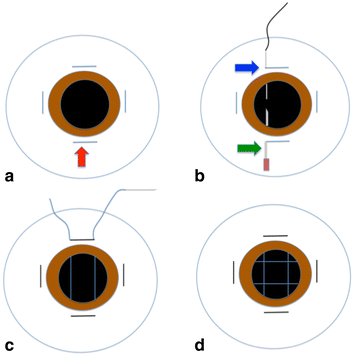 Fig. 1