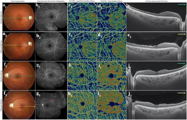 Fig. 2