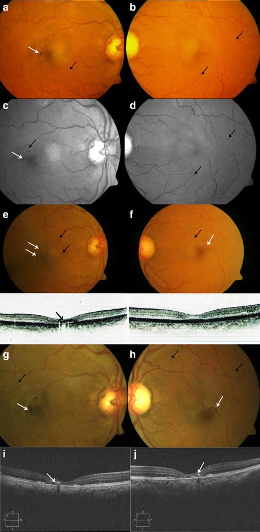 Fig. 1