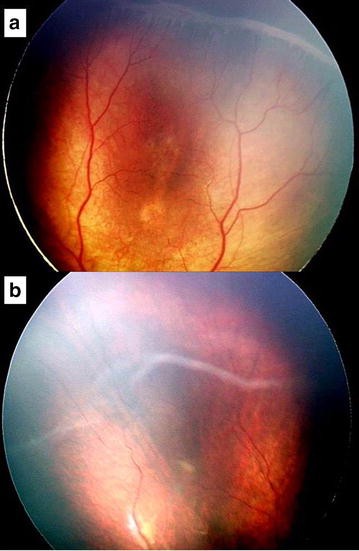 Fig. 1