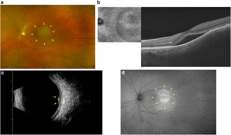 Fig. 1