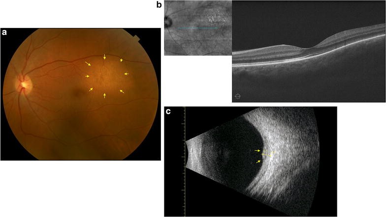 Fig. 2