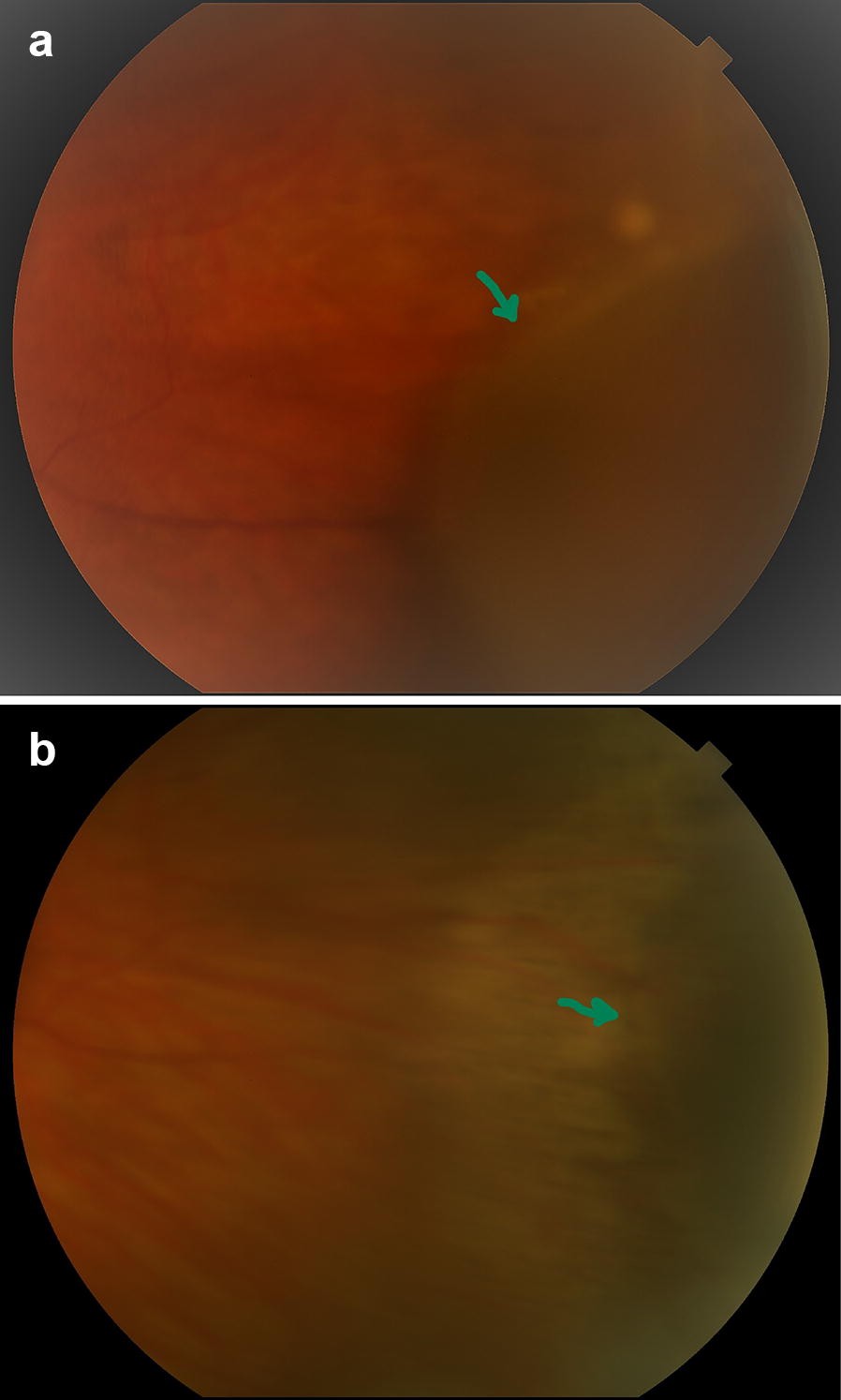 Fig. 2