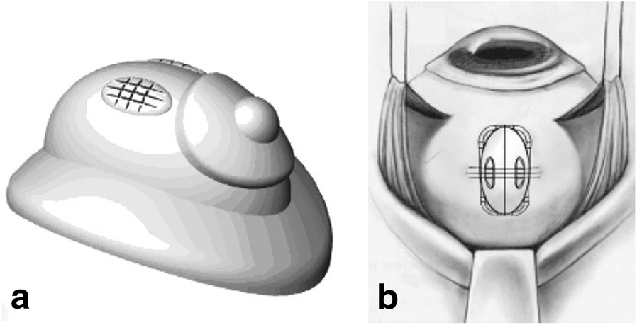 Fig. 1