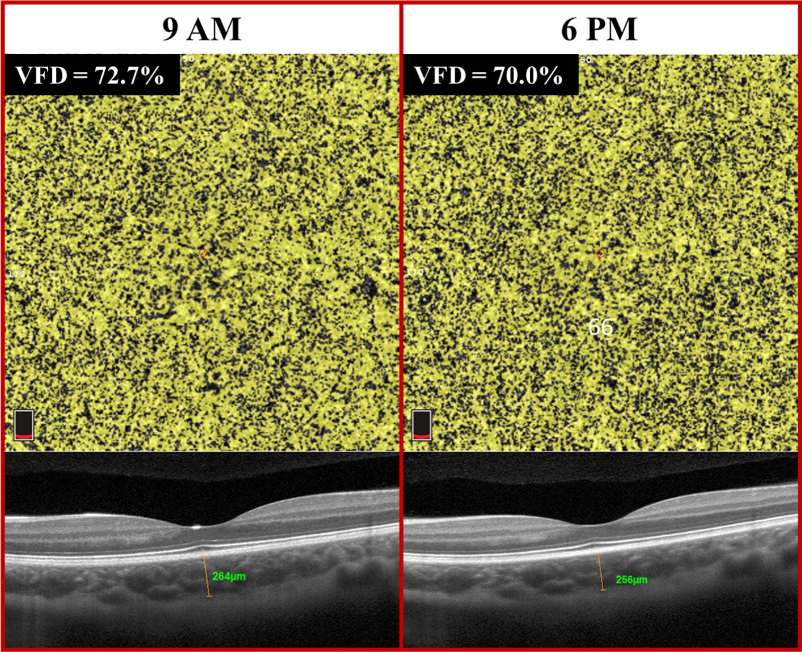 Fig. 4