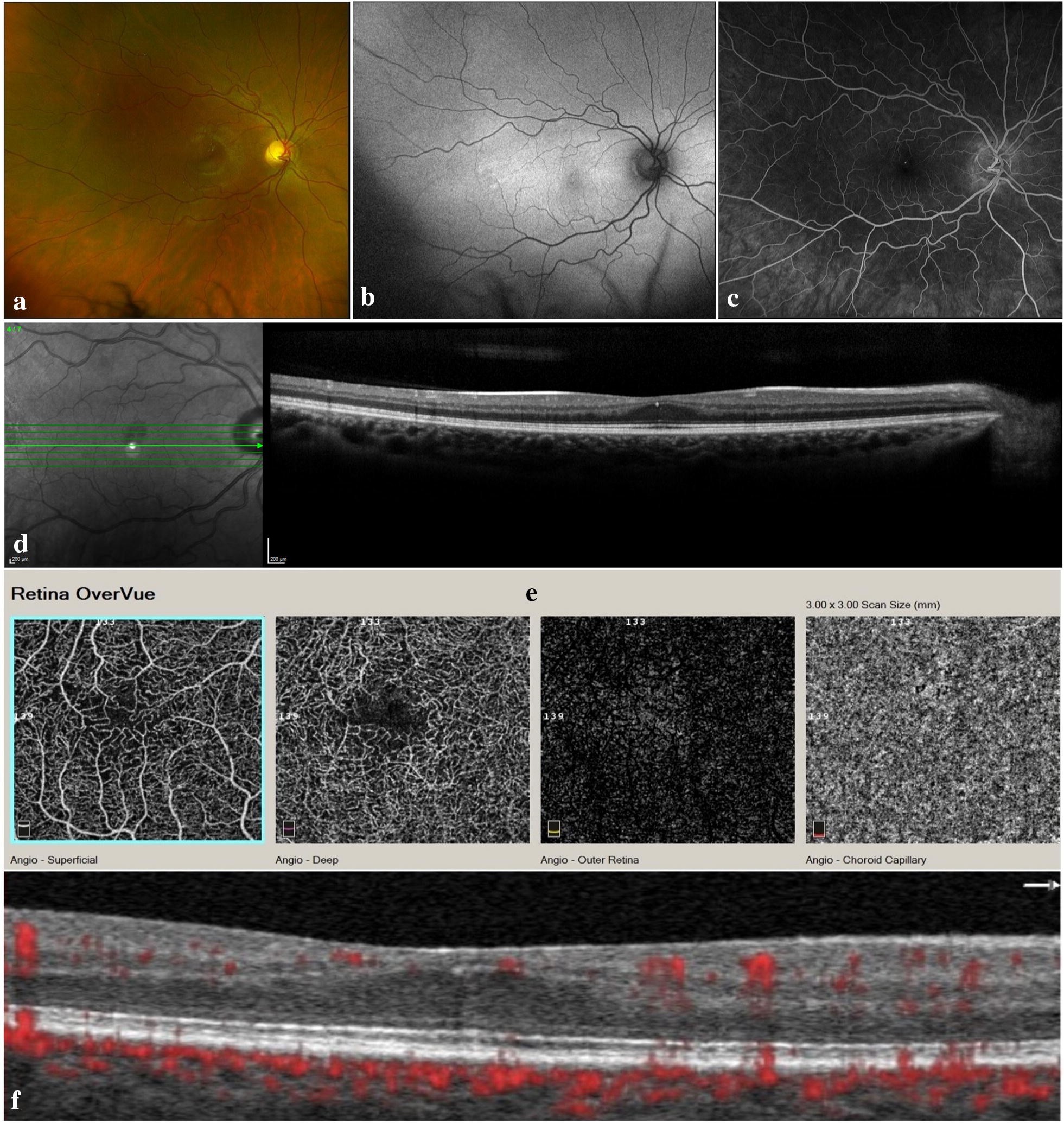 Fig. 1