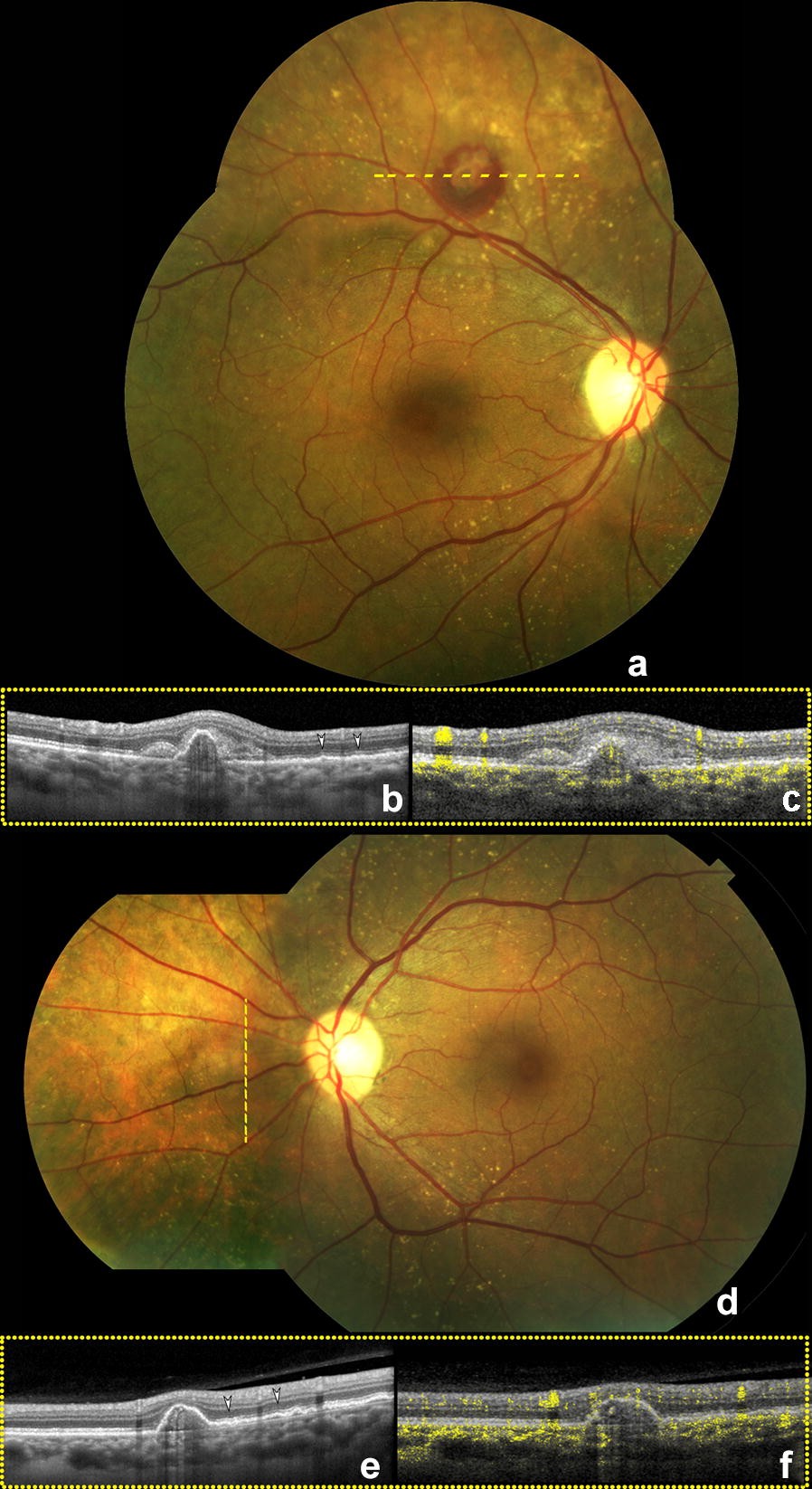 Fig. 1