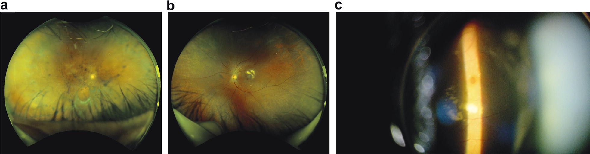 Fig. 1