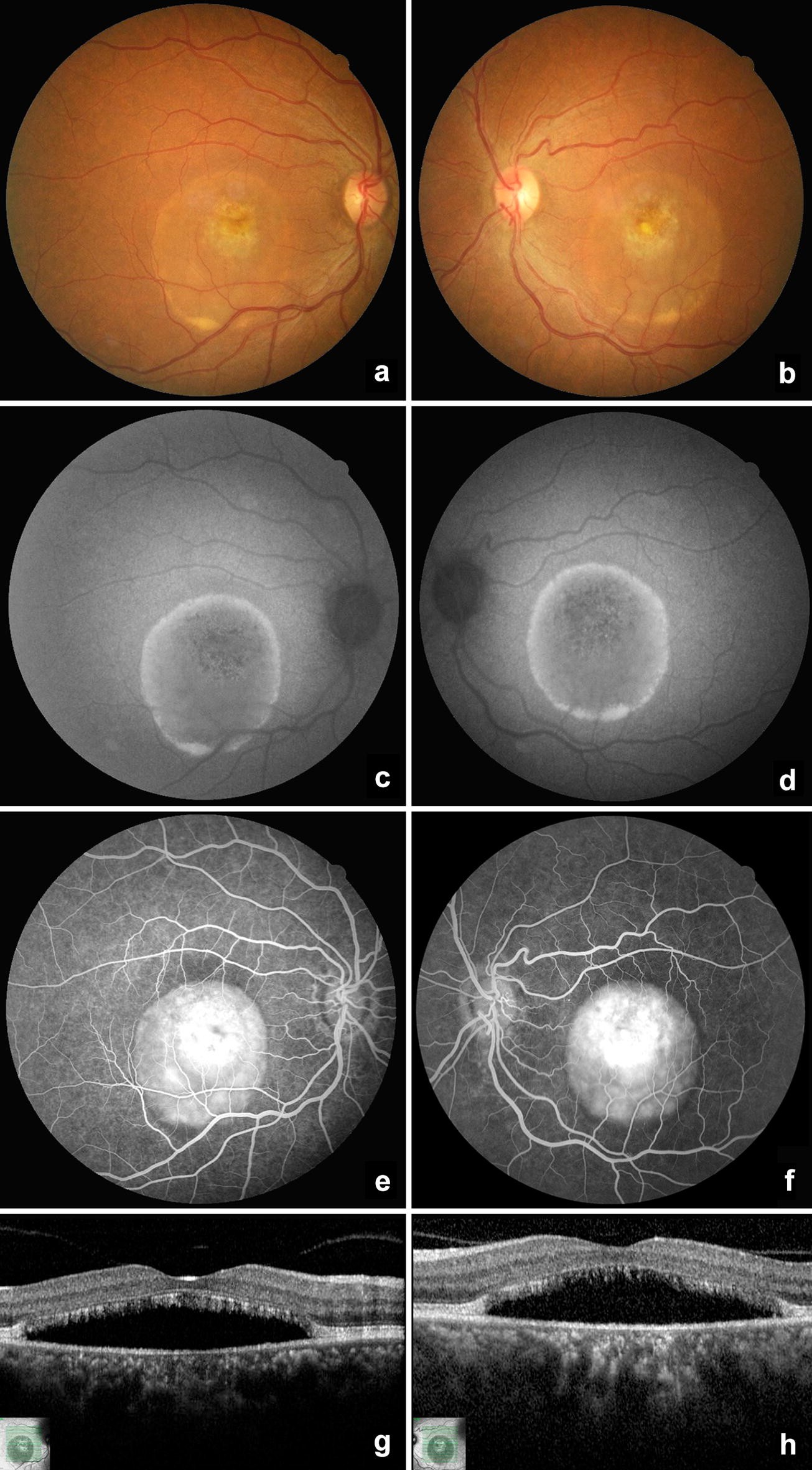 Fig. 2