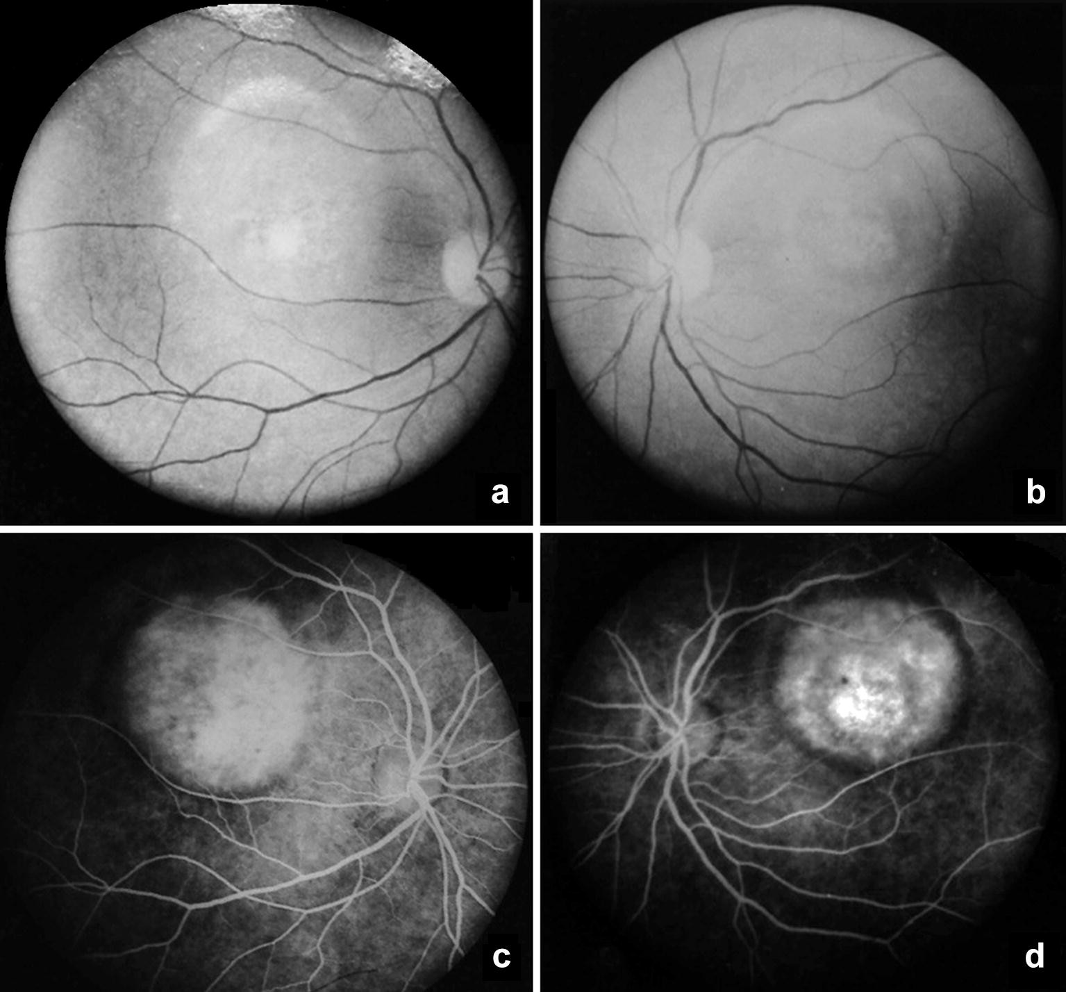 Fig. 4