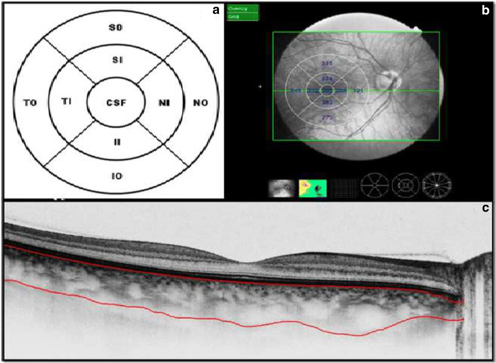 Fig. 1