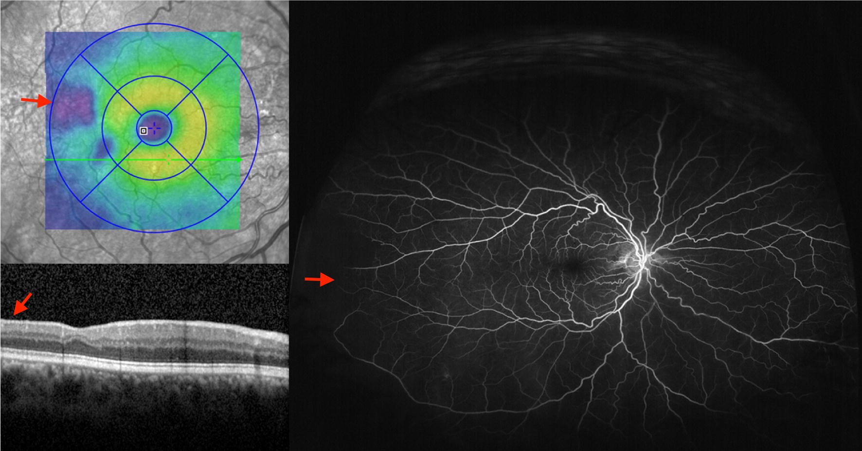 Fig. 11