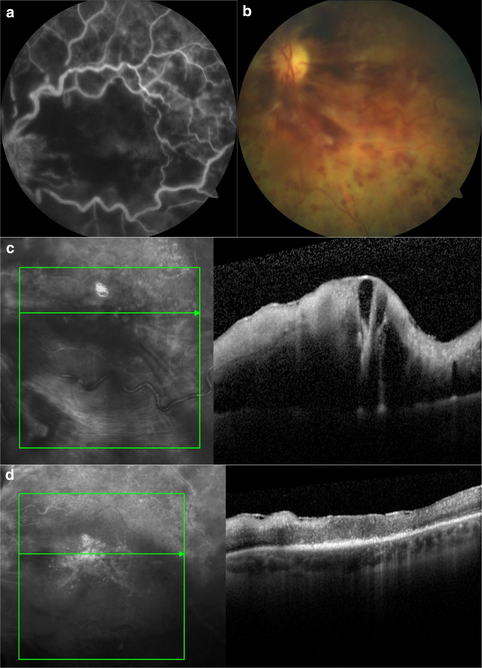 Fig. 1