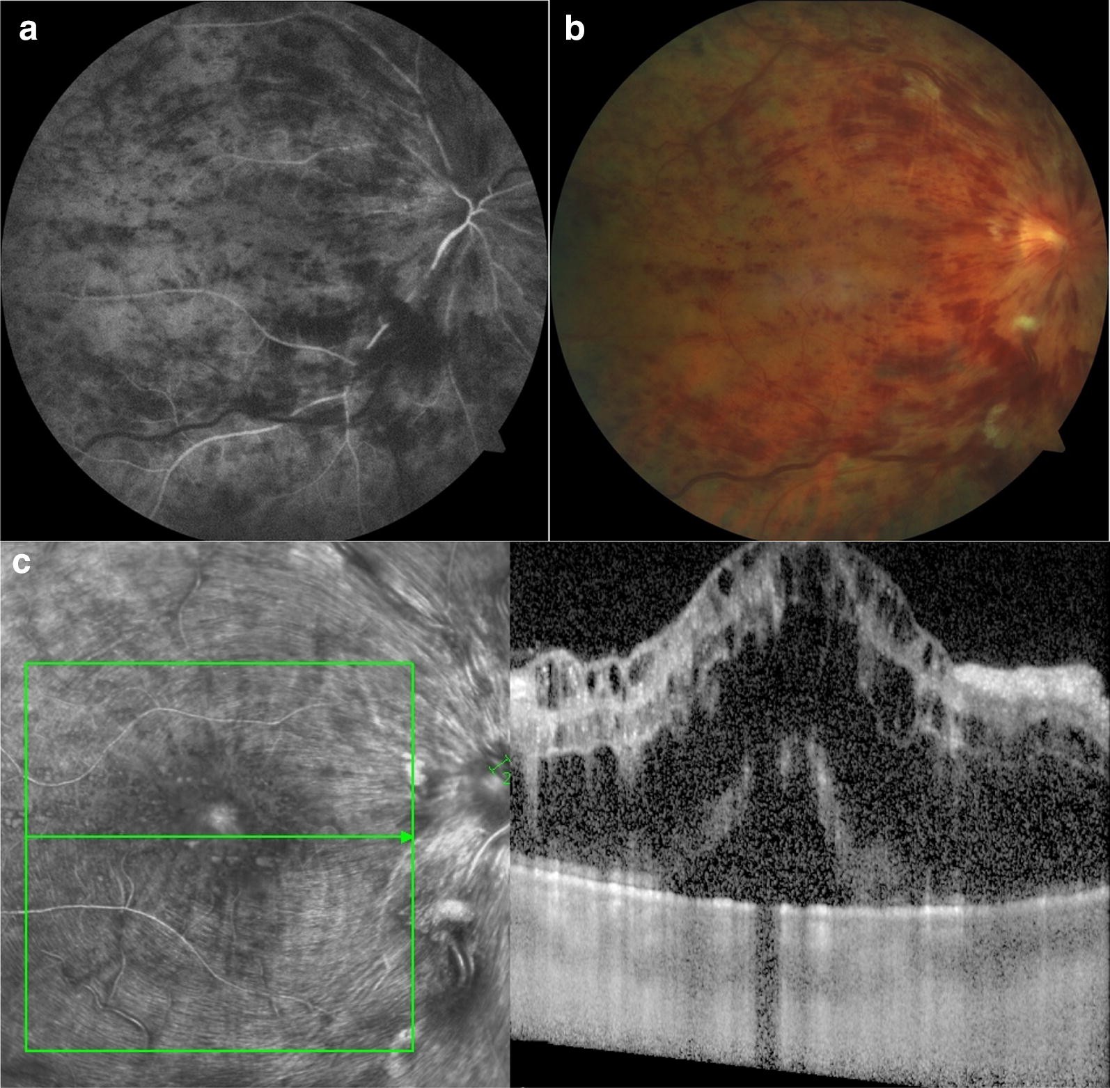 Fig. 2