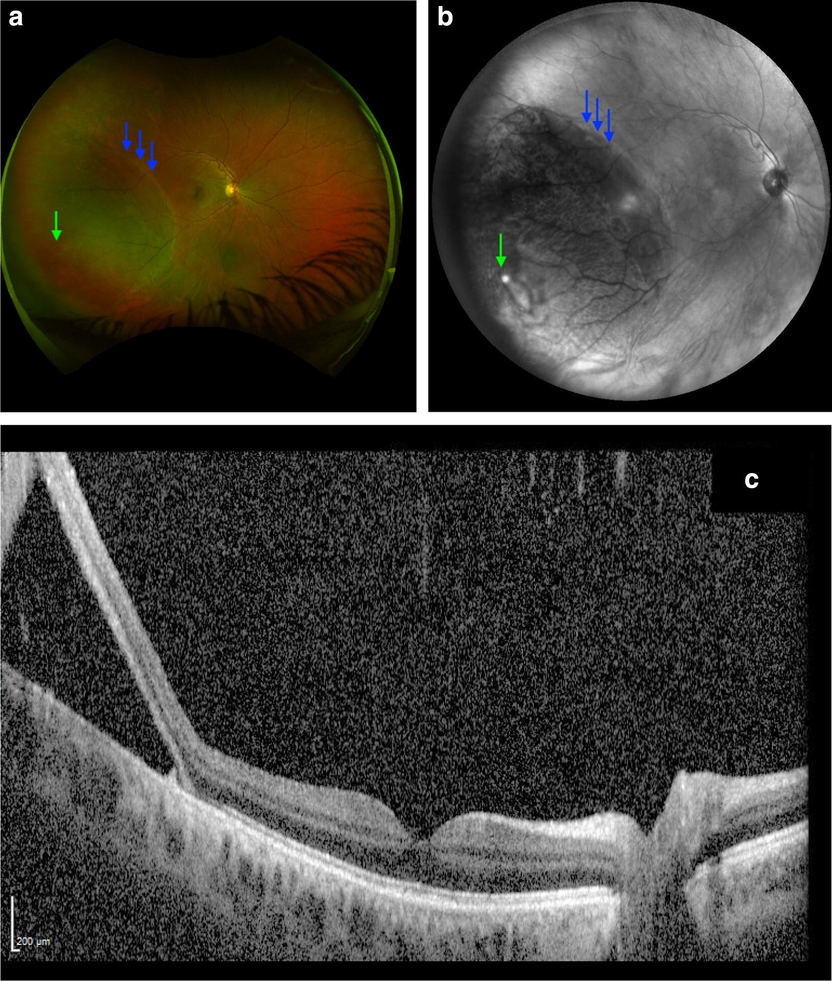 Fig. 2