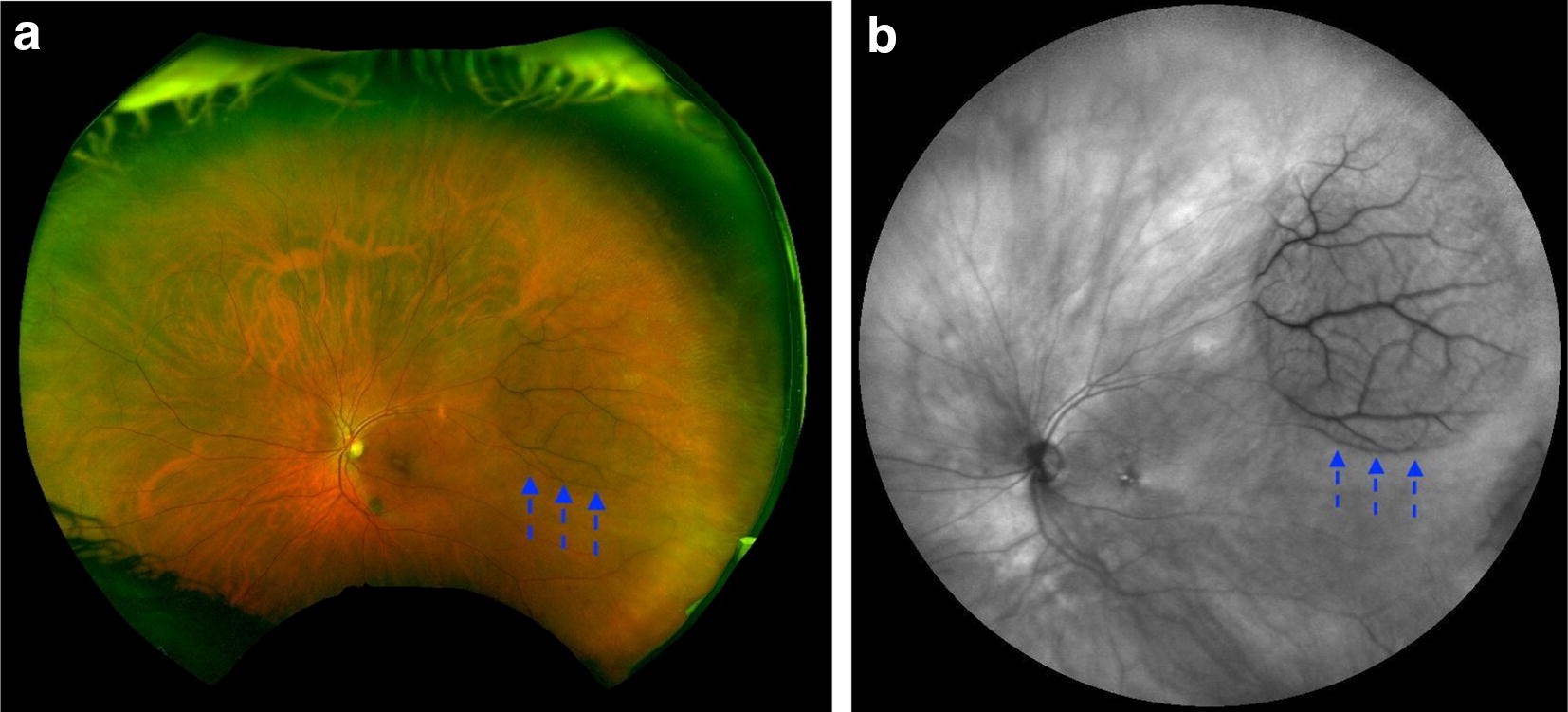 Fig. 3