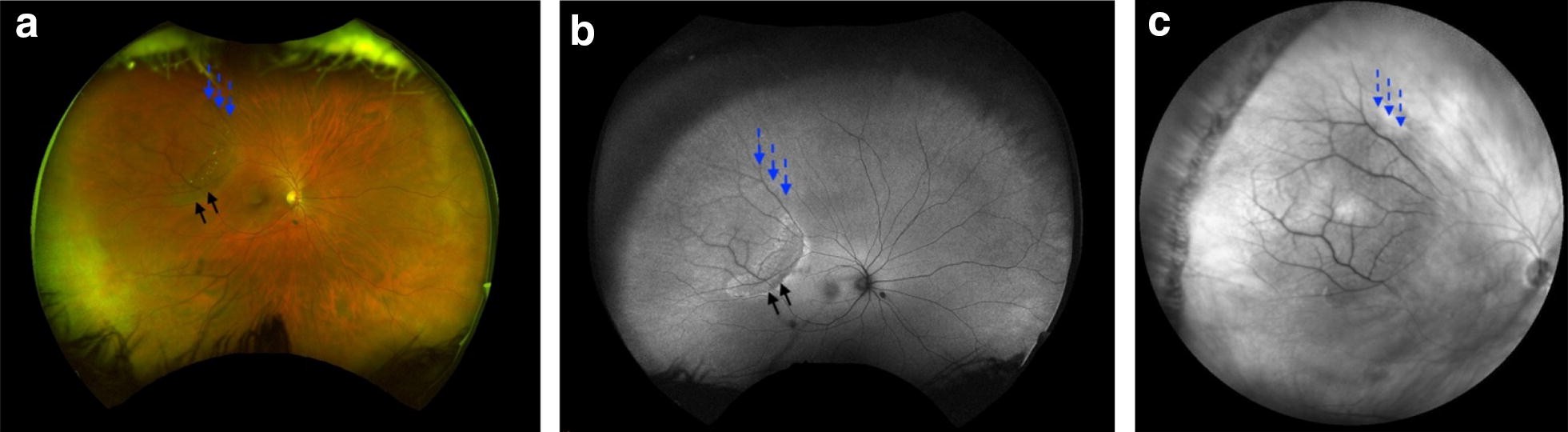 Fig. 4