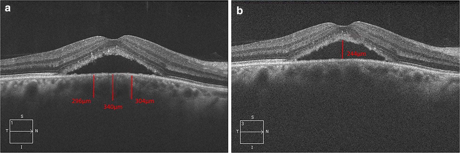 Fig. 2