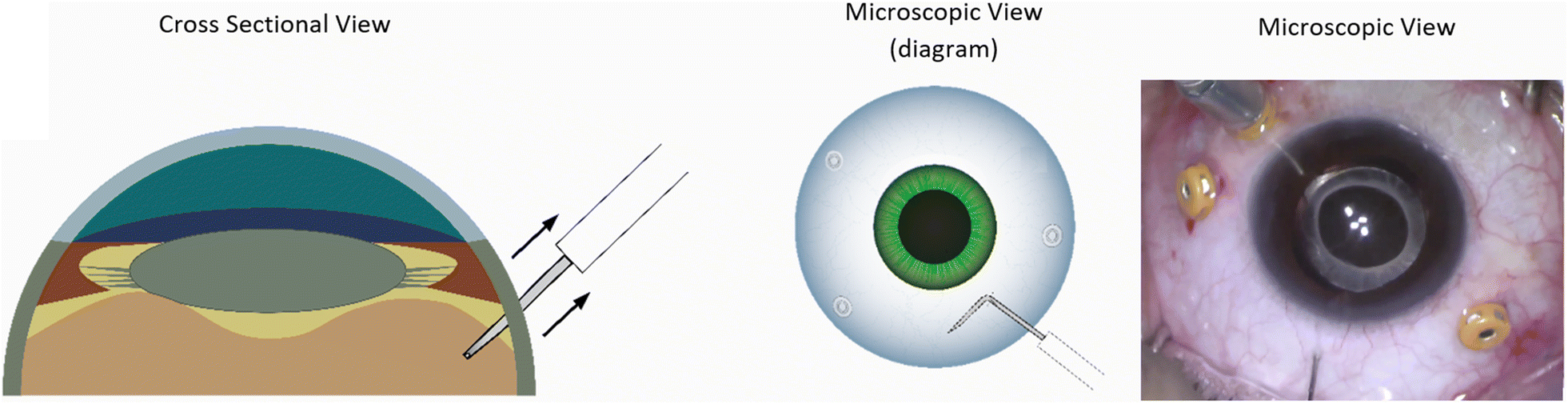 Fig. 2