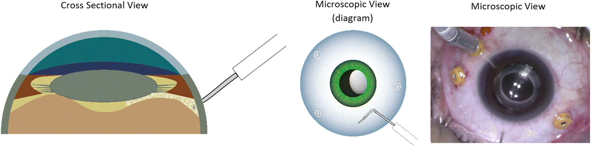 Fig. 3