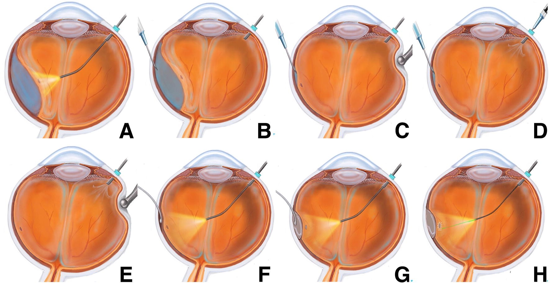 Fig. 1