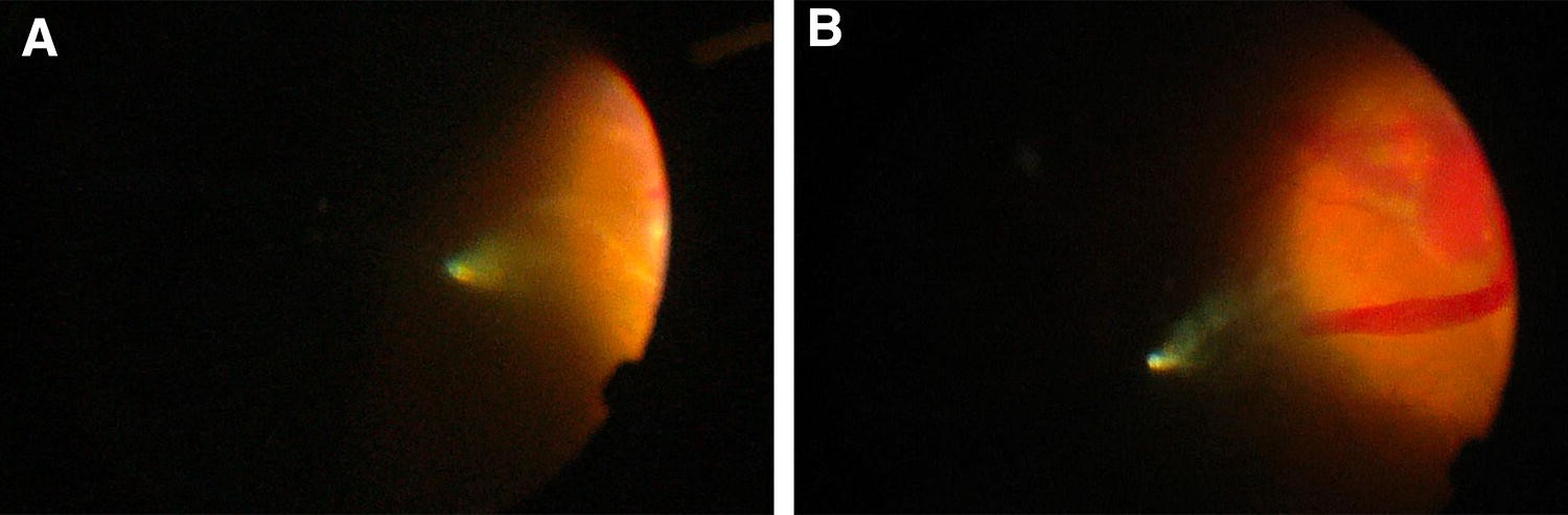 Fig. 3