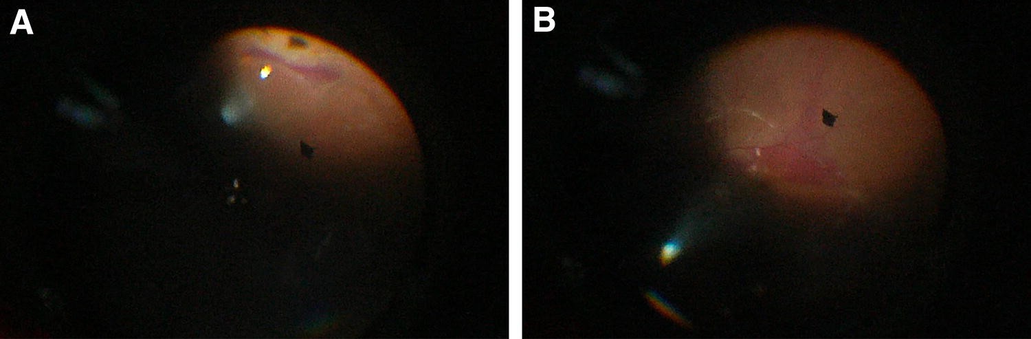 Fig. 4