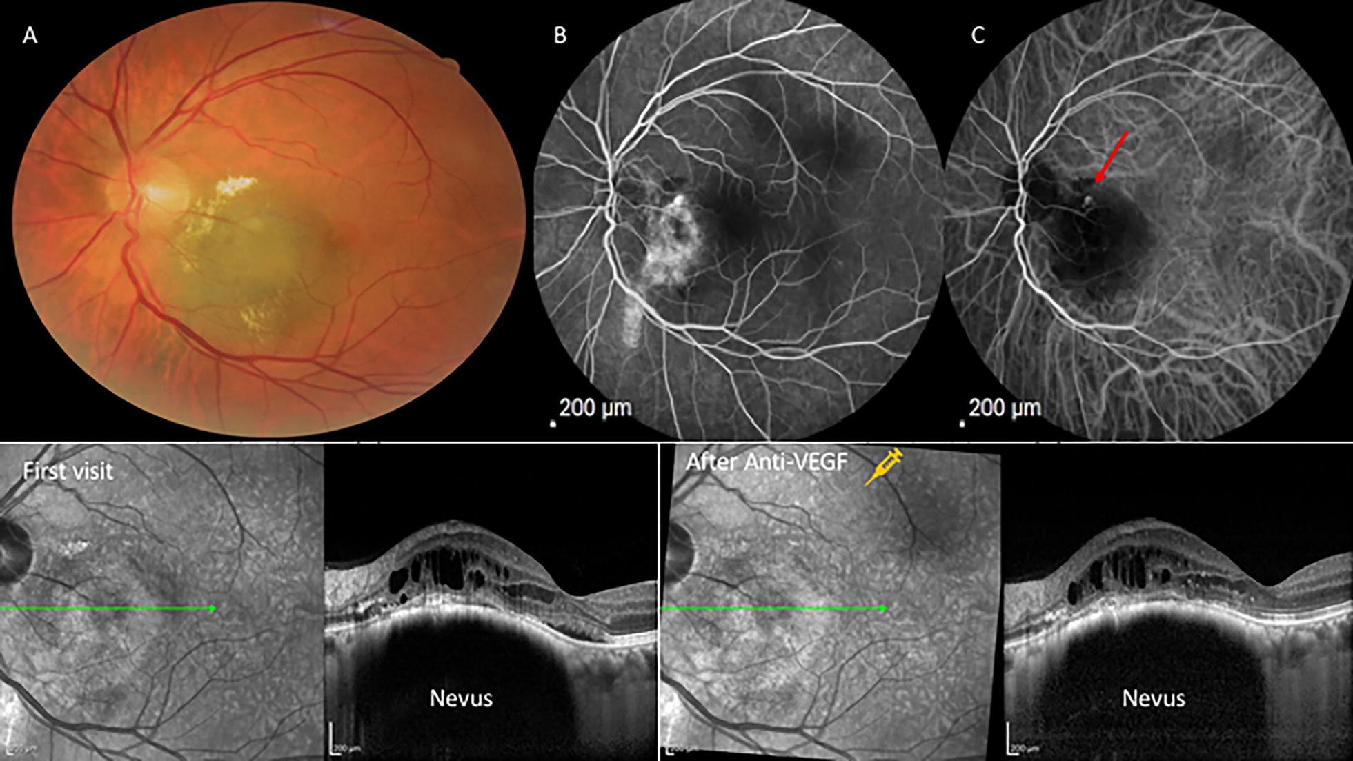 Fig. 2