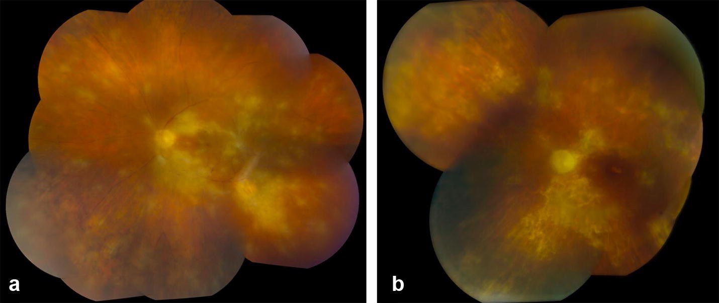 Fig. 2