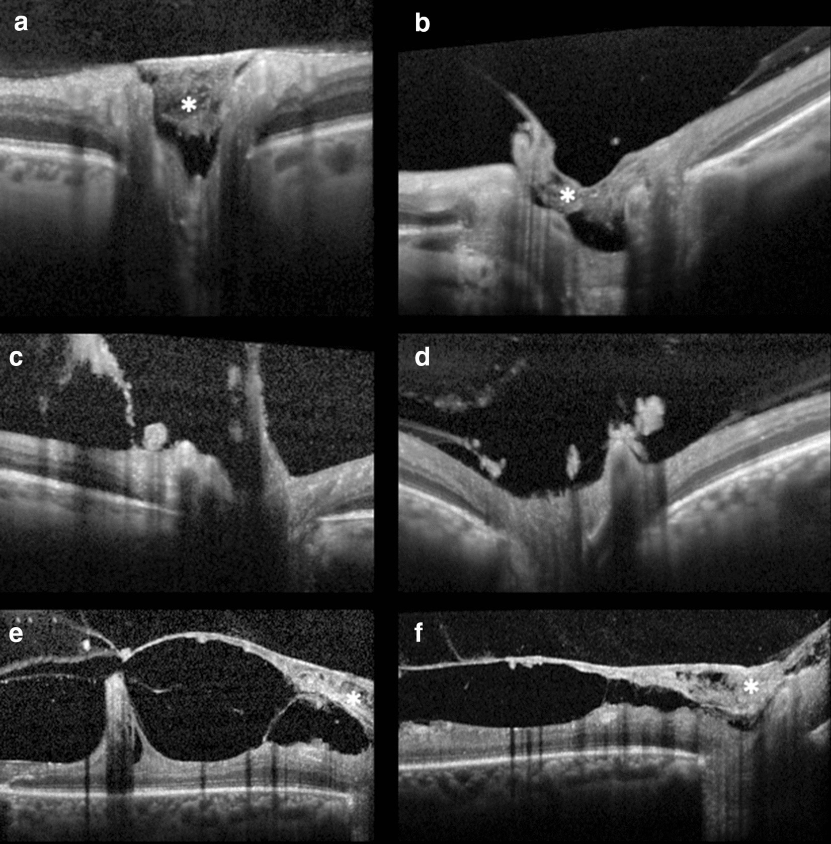 Fig. 2