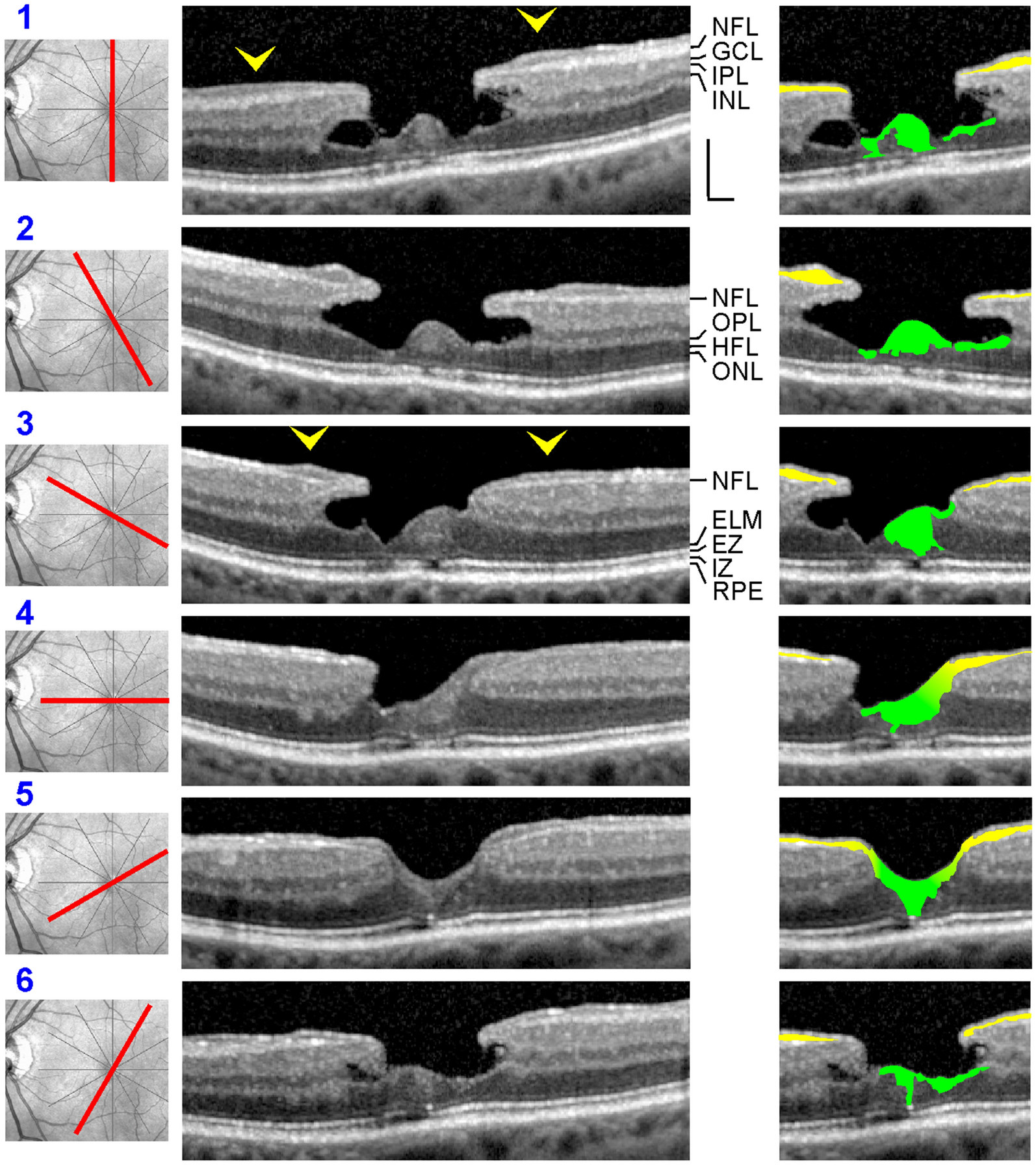 Fig. 5