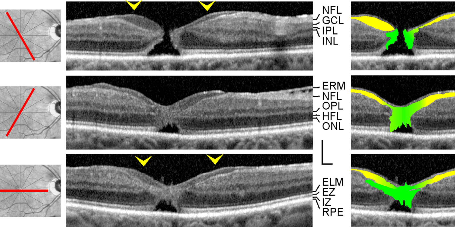 Fig. 6